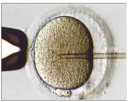 人体显微照片当卵子与精子相遇（组图）183