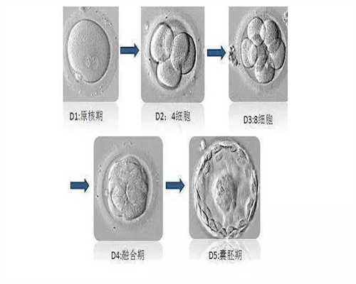 实拍医院人工取卵冻卵受精全过程（图）