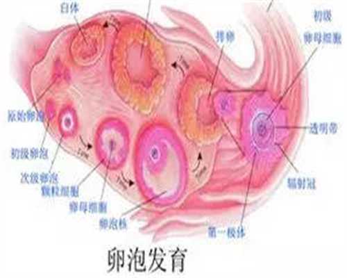 武汉什么样的卵巢囊肿才会造成不孕？