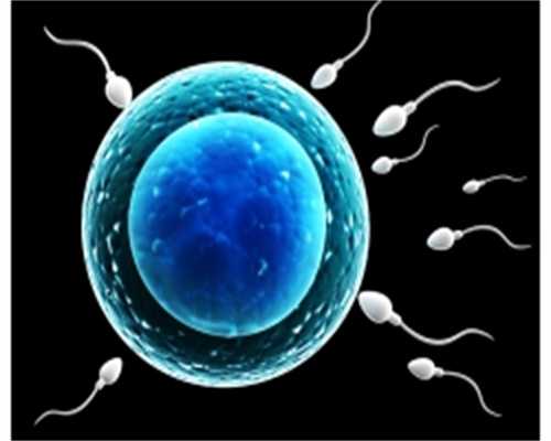 卵巢丨纤维卵泡膜细胞瘤