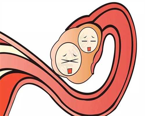 兰州女性卵巢囊肿的症状有哪些