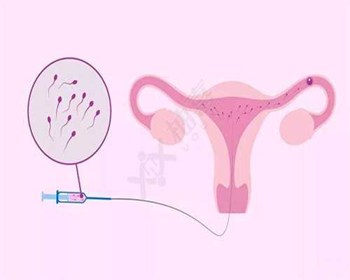 兰州女性多囊卵巢综合症会有哪些症状