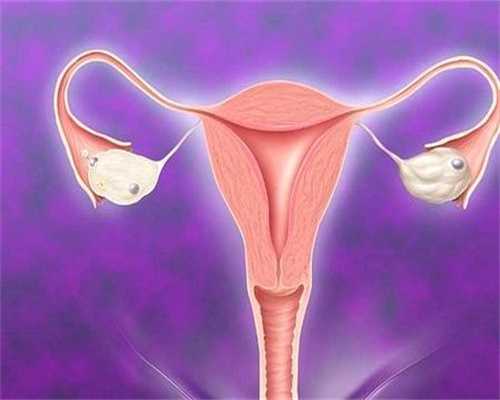 兰州女性卵巢囊肿怎么治疗？
