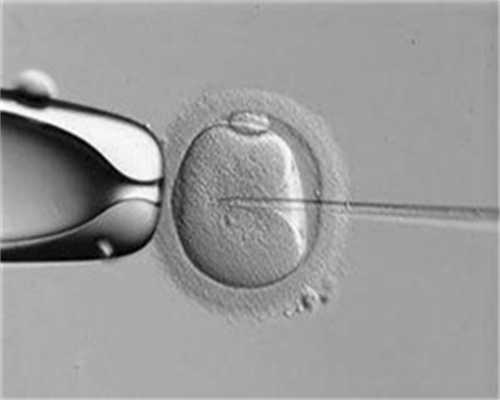 福建捐卵的条件,右卵巢内无回声区是什么