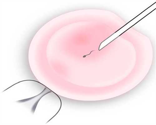 江苏捐卵代孕,卵巢囊肿是否很可怕