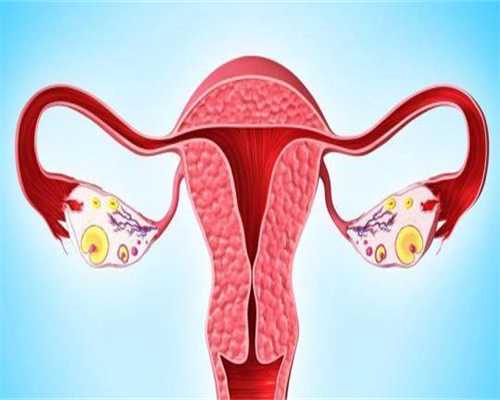内蒙古正规捐卵,有哪些良性卵巢肿瘤最常见