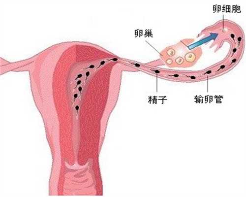 新疆捐卵前检查,左侧卵巢囊肿注意什么事项