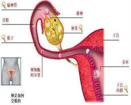 宁夏捐卵代孕,北京代怀孕女性多囊卵巢可以治愈