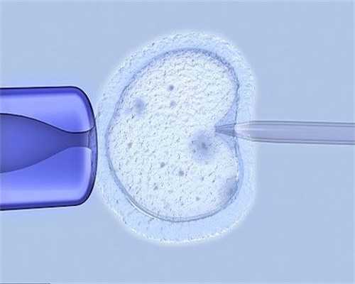 四川捐卵前检查,多囊卵巢综合征的症状是什么？