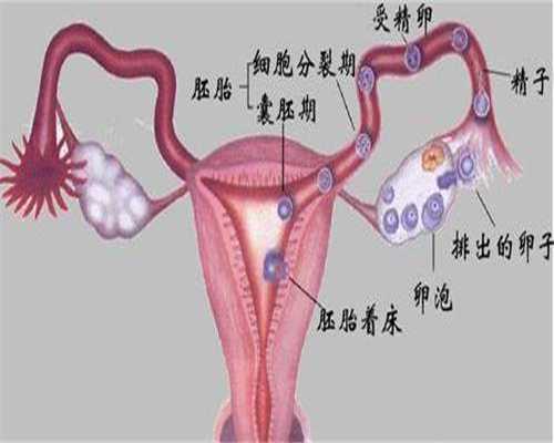青海捐卵子,卵巢囊肿的发病机制是什么_1