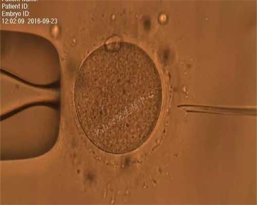 辽宁捐卵的好处,卵巢囊肿的治疗前应先辨别性质