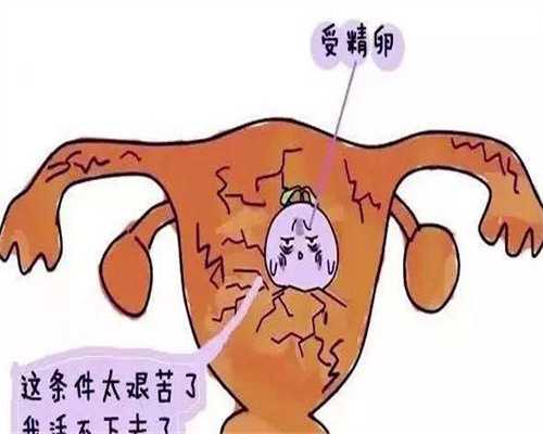 台湾捐卵者,左卵巢低回声区是什么意思