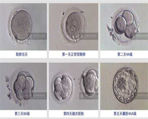 宁夏国外捐卵,卵巢囊肿会造成什么危害