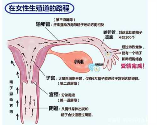 香港面试捐卵,内膜异位与卵巢囊肿有没有关系