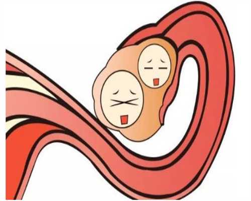 宁夏捐卵的条件,卵巢囊肿疾病会推迟例假吗