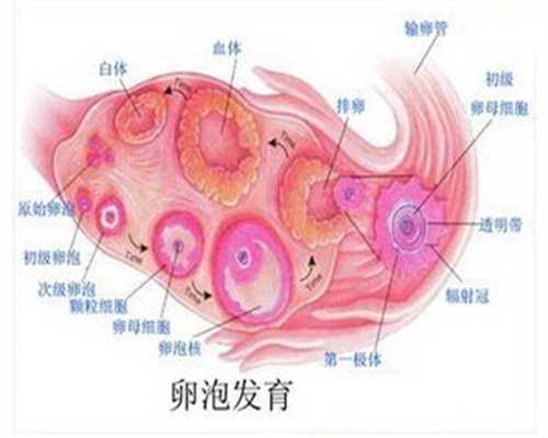 黑龙江捐卵者,卵巢囊肿的手术指征 卵巢囊肿的症