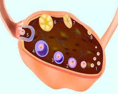 四川捐卵的经历,卵巢囊肿的形成原因有哪些？