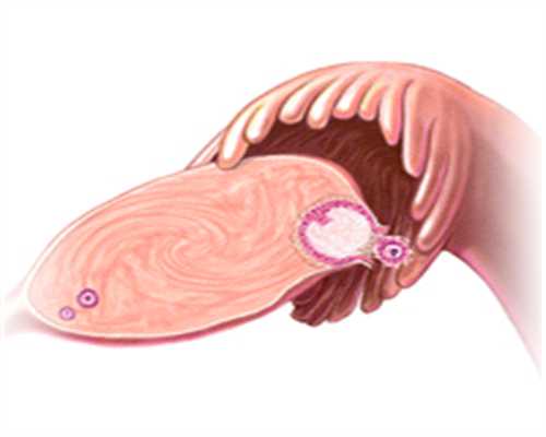 甘肃华裔捐卵,卵巢囊肿究竟有哪些表现 卵巢囊肿可用几种方法检测