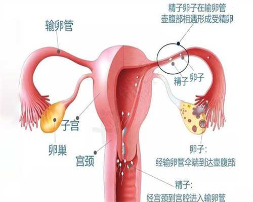四川女性捐卵,宫颈囊肿0.5-0.6严重吗