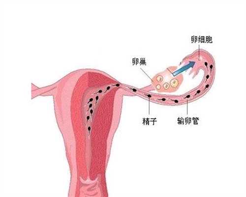 安徽捐卵的流程,多卵巢囊肿要怎么北京代怀孕