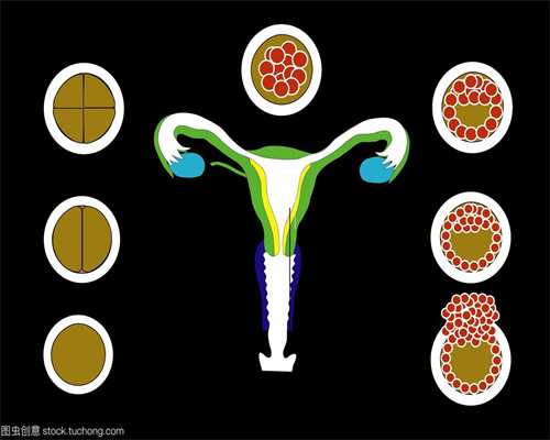 台湾捐卵哪里找,卵巢囊肿是什么样子的 卵巢囊肿的主要特点揭秘