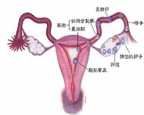 青海捐卵标准,卵巢囊肿的预防方法有哪些？