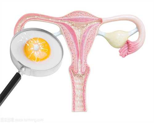 重庆招捐卵,多囊卵巢患者导致不孕该怎么办