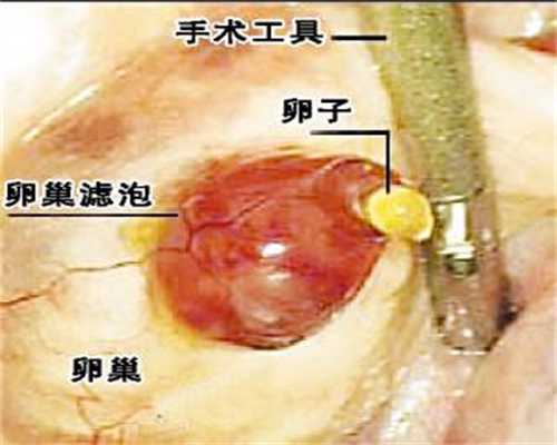 成都中国捐卵网~日本试管婴儿预移植阶段除了选择优质精卵，还要培养优质胚