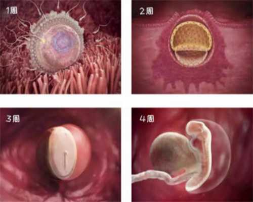 青海捐精捐卵-卵巢刺激综合症的发生率和治疗